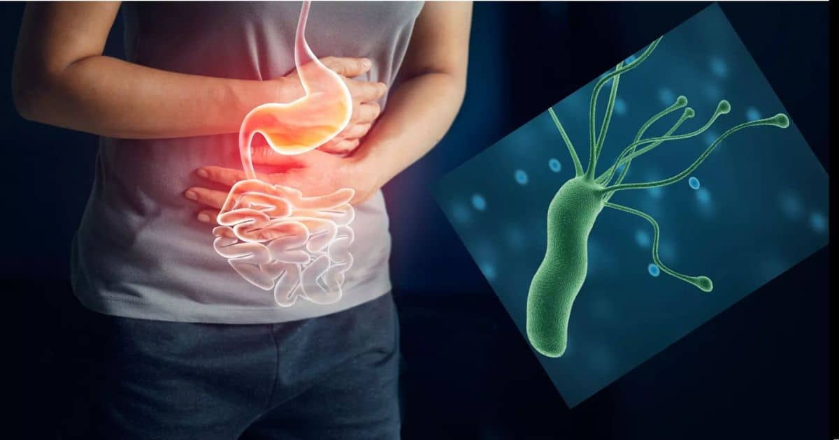 Helicobacter pylori: la bacteria silenciosa